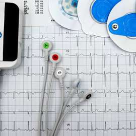 Cardiac event recorder