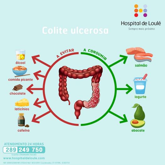 Ulcerative colitis