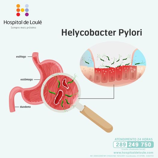 Já ouviu falar na Helycobacter Pylori?