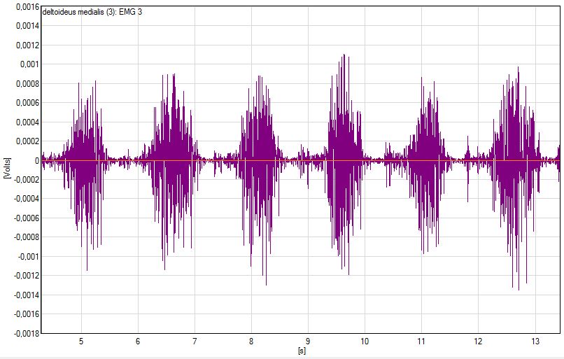 Electromyogram